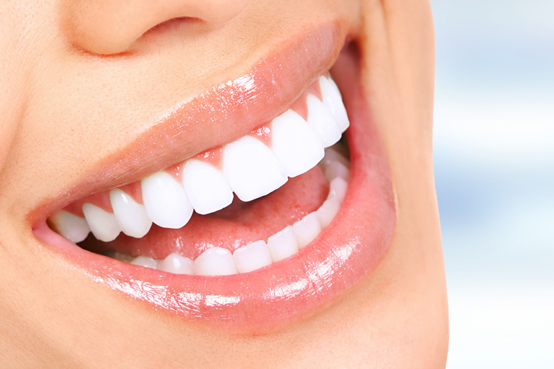 Quality Dental Treatments in Roswell